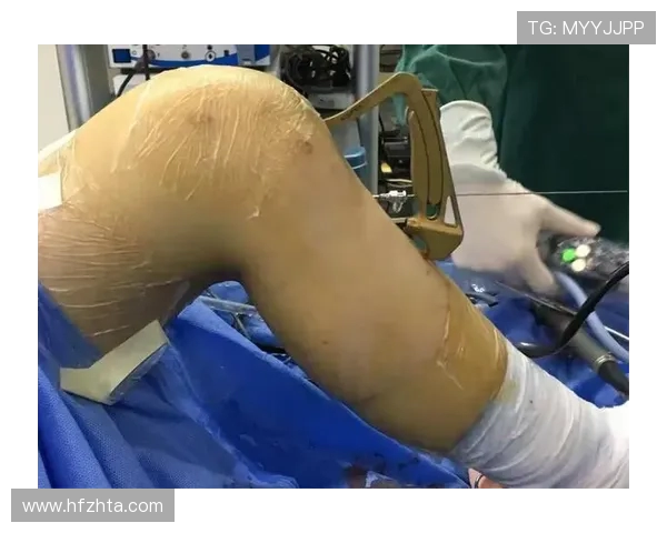 活塞官方宣布艾维接受右膝关节镜手术 预计四周后复查恢复情况